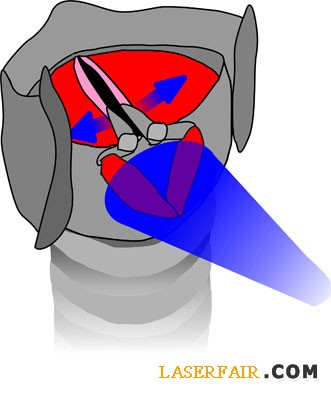 BIO_larynx_1