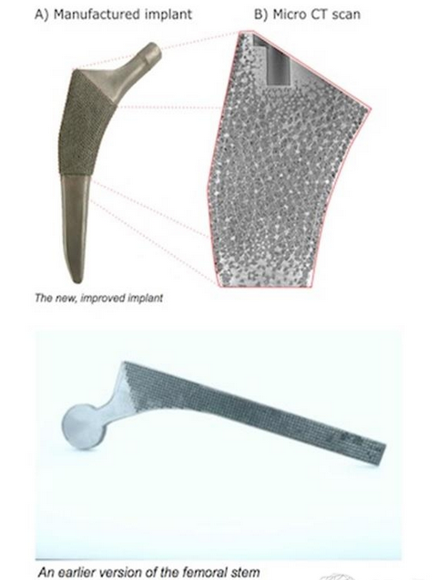 MicGill大學推出接近天然骨的多孔3D打印骨骼植入物國外新聞3D虎