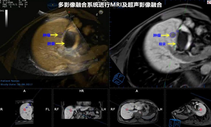 QQ瀏覽器截屏未命名